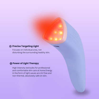 Bye Acne- Dual Light Acne Therapy